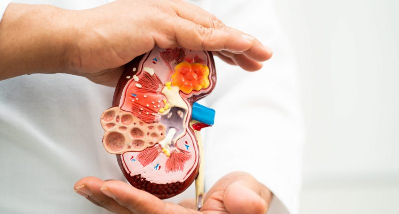 Diagram of a kidney