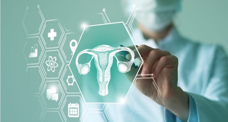 Doctor investigating an image of a uterus