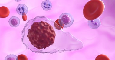 Myelofibrosis cells in blood flow