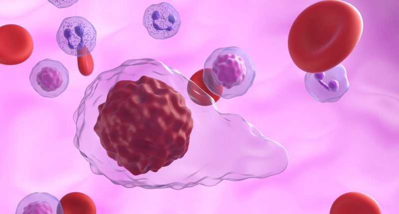 Myelofibrosis cells in blood flow