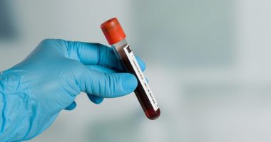 Blood sample blood test blood concept