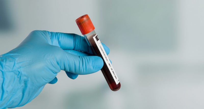 Blood sample blood test blood concept